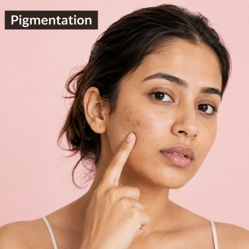 Pigmentation